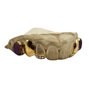Amethyst Molar Grillz w Floating Diamond Tips